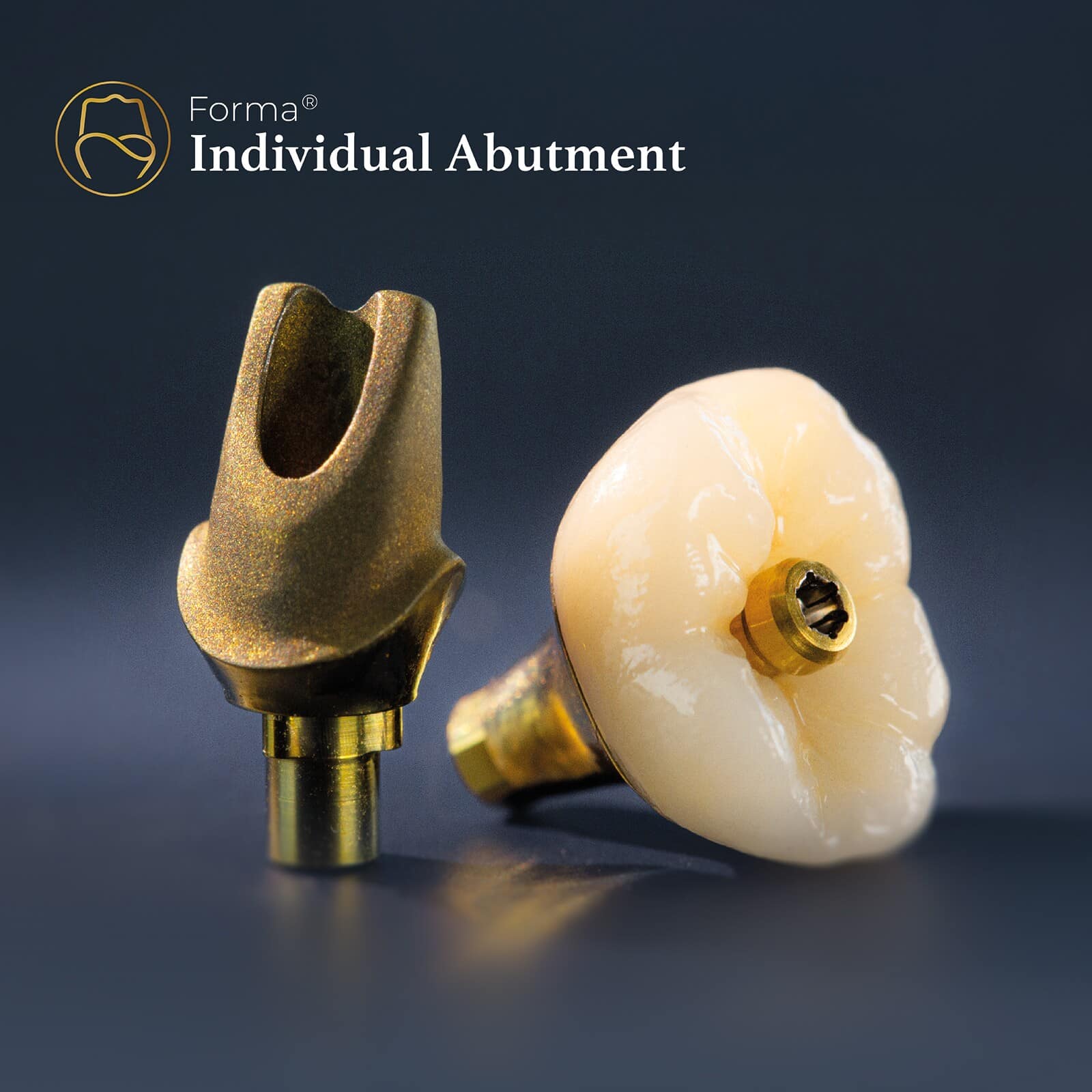 Le Pilier personnalisé