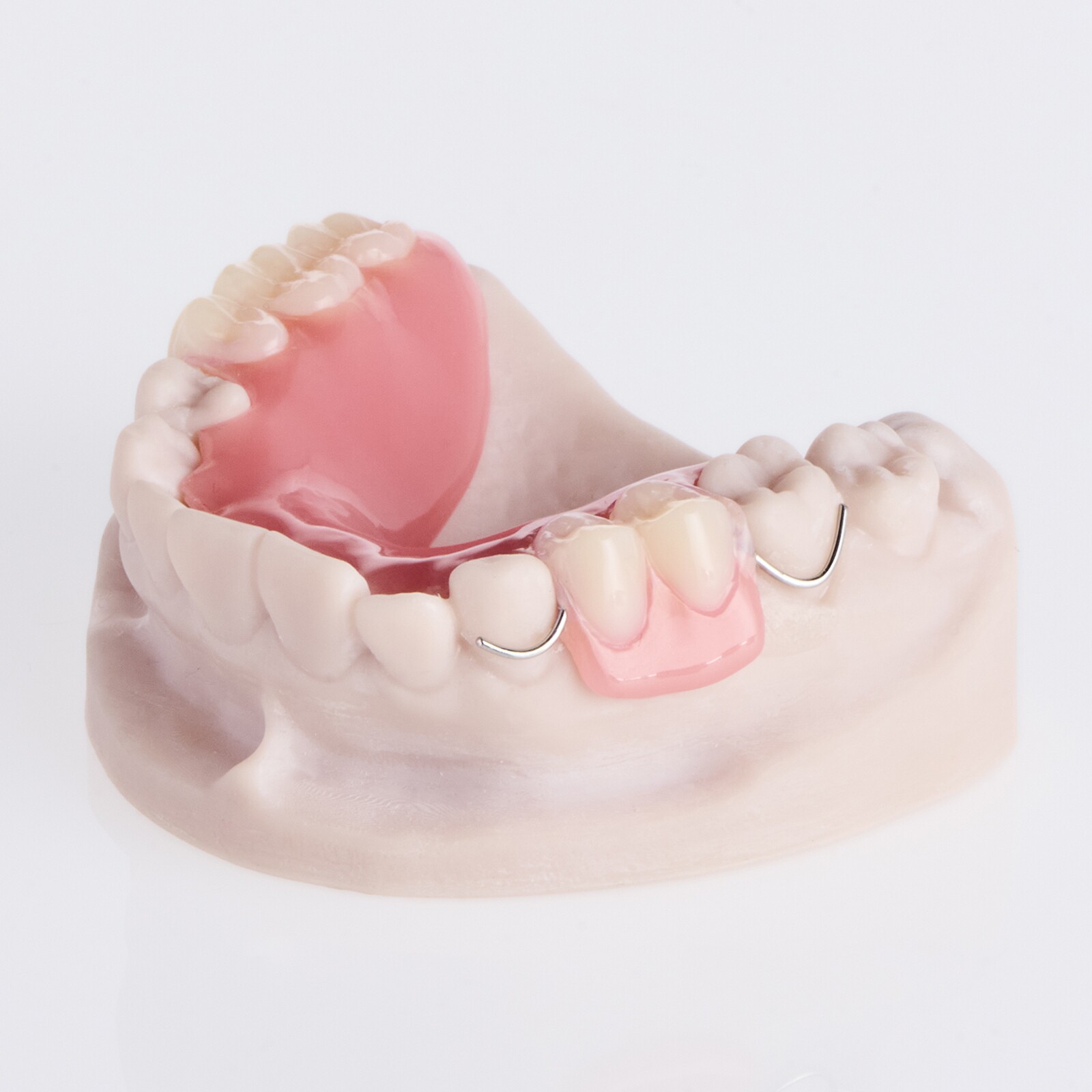 La prothèse flexible