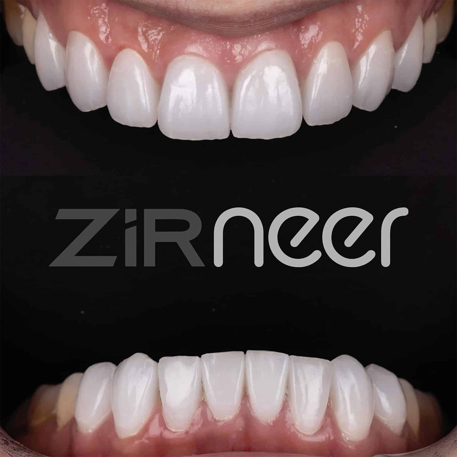 ZirNEER